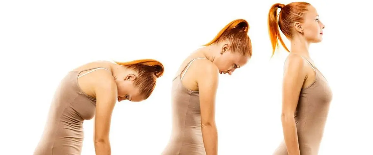 POSTURA E CELLULITE POSTURA E CELLULITE