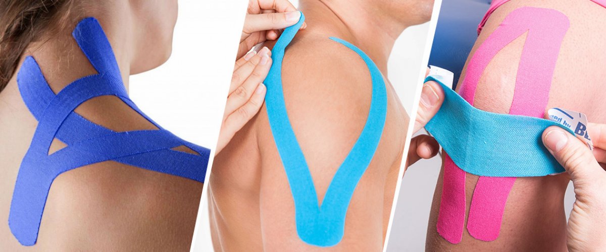 KINESIOTAPING KINESIOTAPING