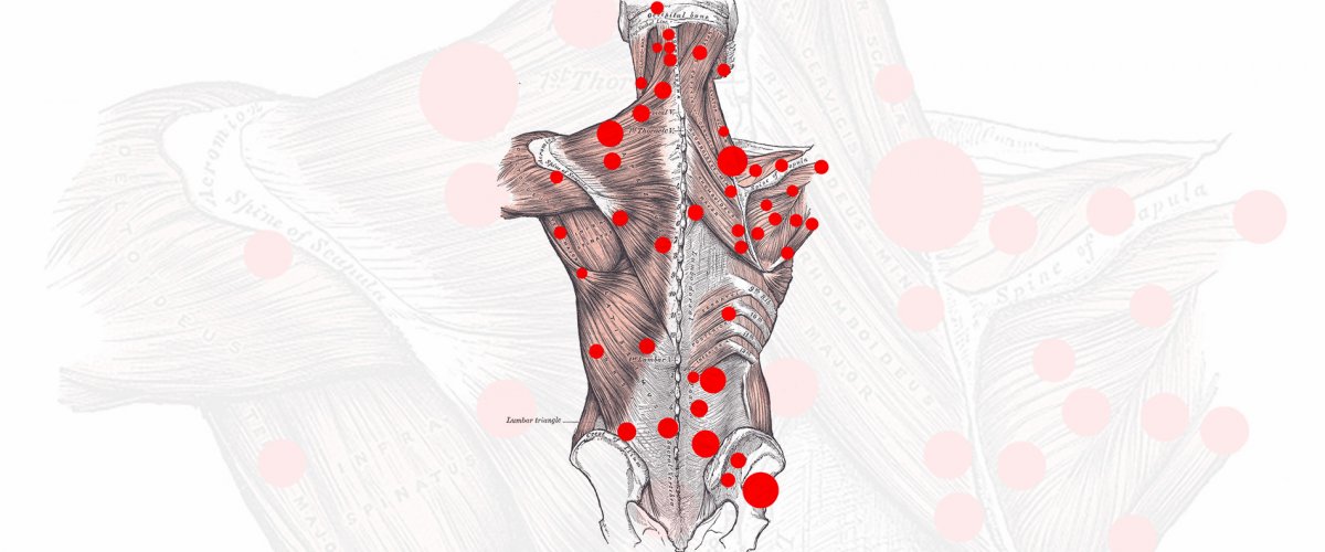 DEEP TISSUE MASSAGE E TRIGGER POINTS DEEP TISSUE MASSAGE E TRIGGER POINTS